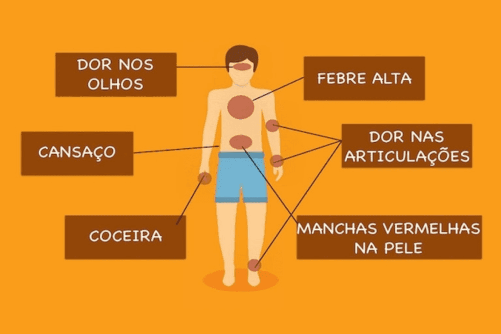 Os principais sintomas da Chikungunya costumam surgir entre 2 e 7 dias após a picada do mosquito
