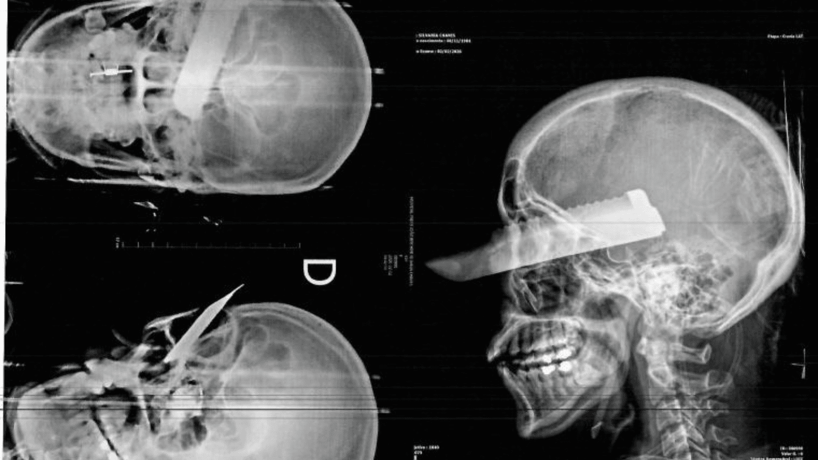 Prisão após tentativa de feminicídio em São Carlos mobiliza forças de segurança