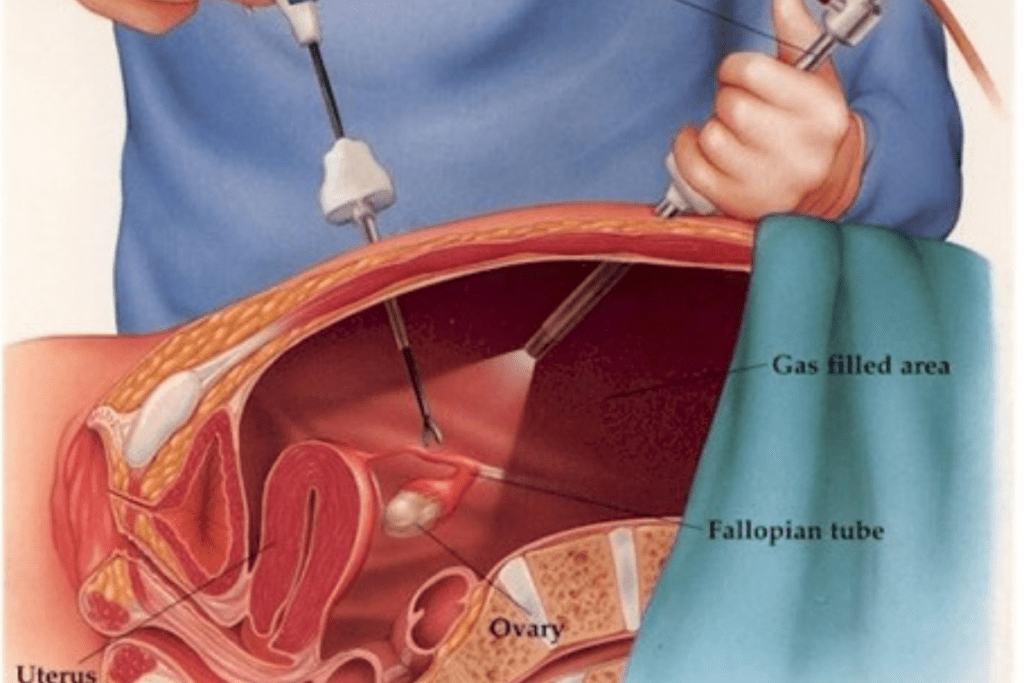 Cirurgia laparoscópica e robótica